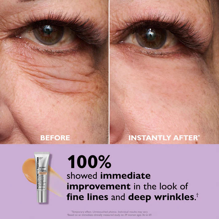 PerfectionLift™ - Rajeunissement instantané de 10 ans en 60 secondes