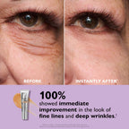 PerfectionLift™ - Rajeunissement instantané de 10 ans en 60 secondes
