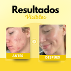 Dermaluxe - Hydrate Instantanément et Répare en Profondeur la Peau Sèche et Sensible