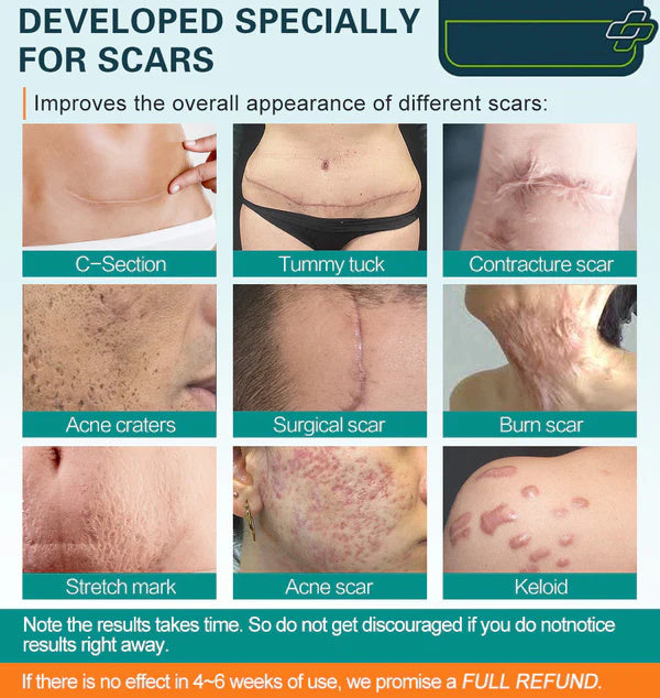 Une peau sans cicatrices, plus vite que jamais - Le spray cicatrisant avancé ultime