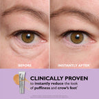 PerfectionLift™ - Rajeunissement instantané de 10 ans en 60 secondes