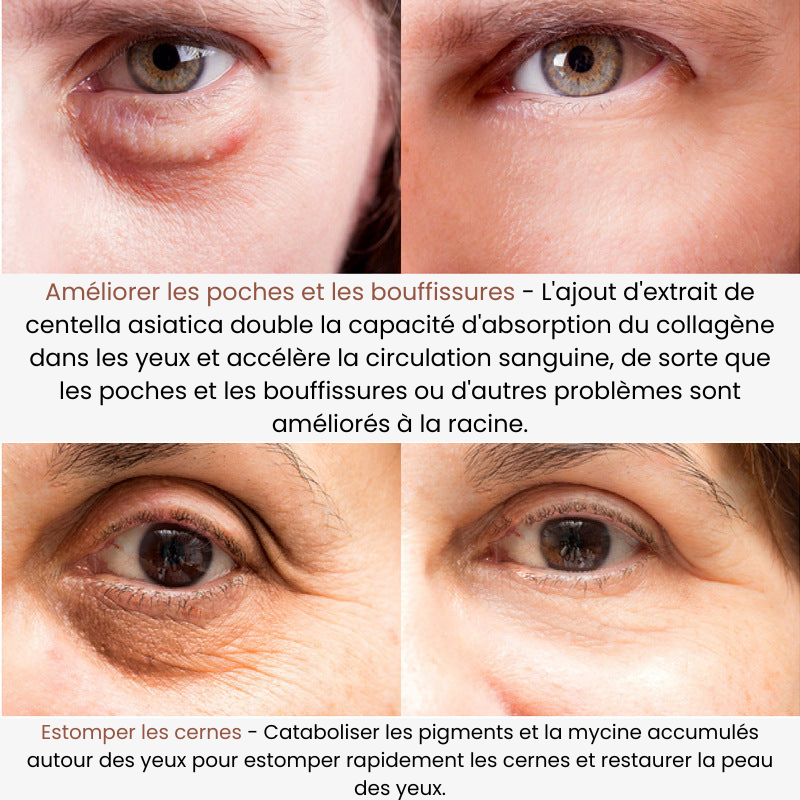 EyeShine™ - Nourrit et réhydrate la peau du contour des yeux