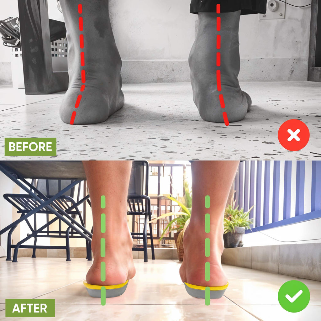 StrideEase - Soutien Confortable et Apaisant pour les Pieds Fatigués Toute la Journée