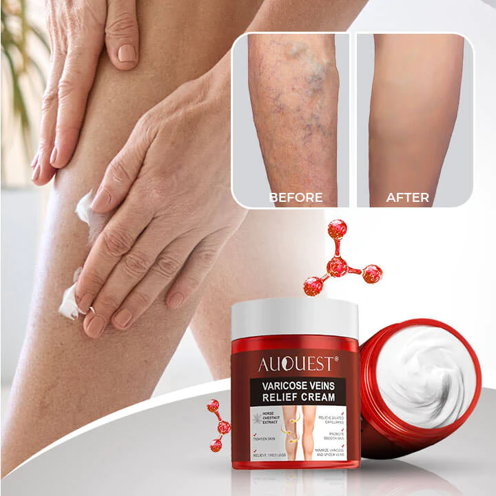 VeinoGel™️ - Varicose Veins Relief Cream by Auquest®️ – Trevibe